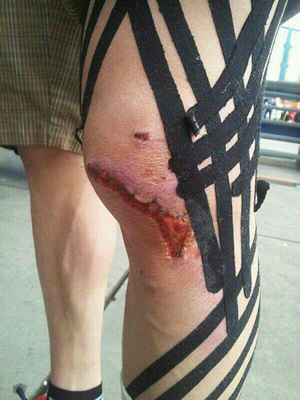 Leon Camiers knee injury, pretty gruesome stuff!